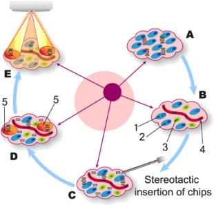 Chip in Tumour