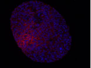 Figure shows immunofluorescent image of a 3D tumour spheroid.  Cell nuclei are stained in blue.  Red stain shows cells in low oxygen areas (hypoxia), where more treatment resistant cells are found. 